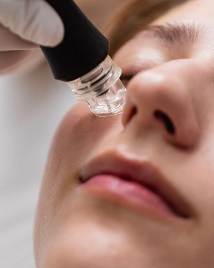Chica recibiendo una limpieza facial profunda